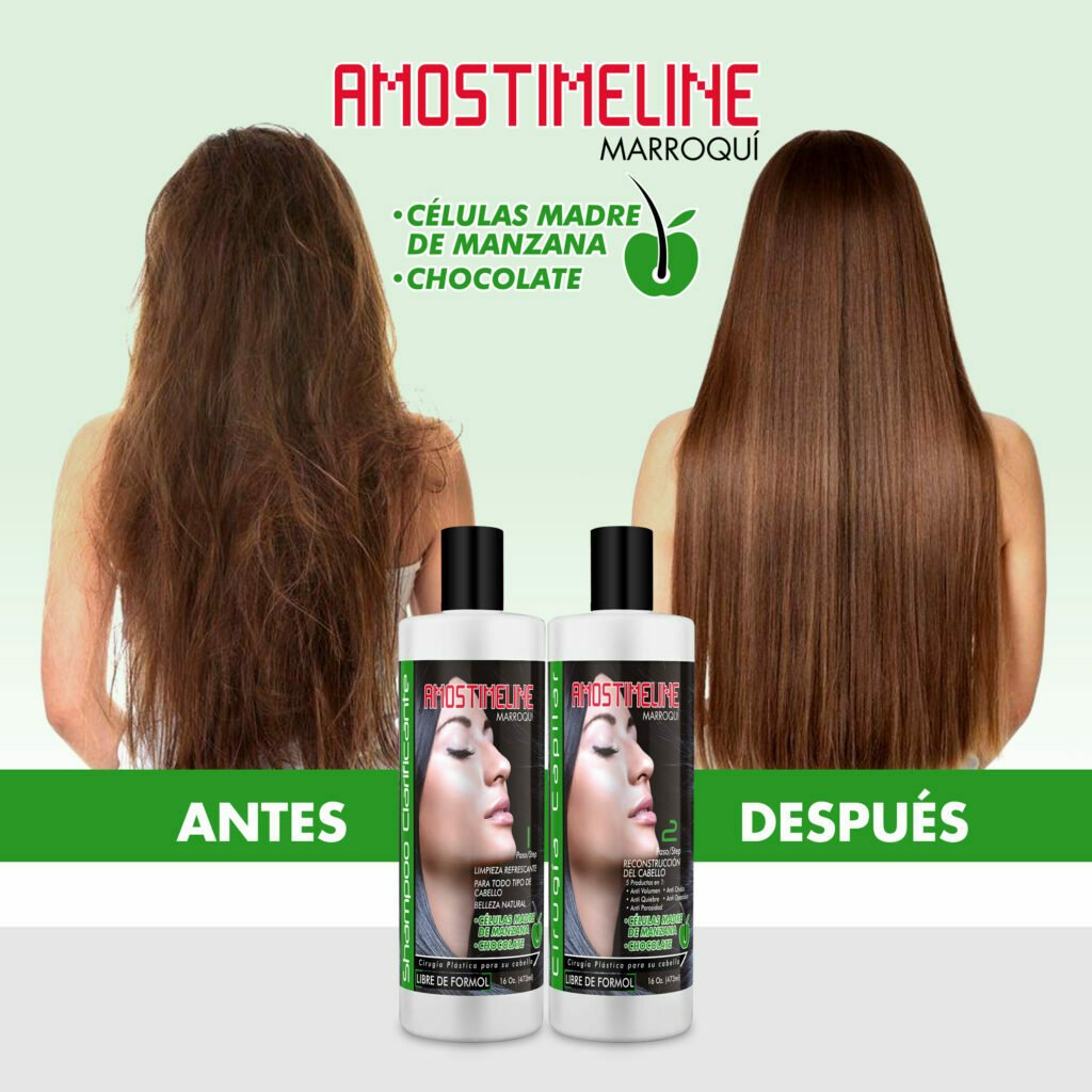 Beneficios de la cirugia capilar en un antes y despues como queda el cabello