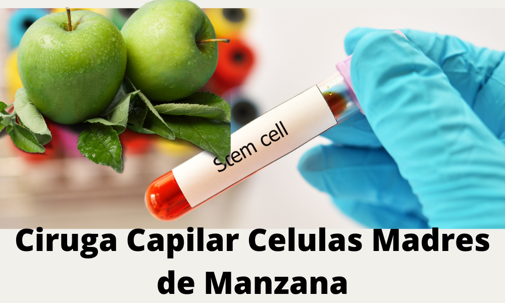 Cirugia capilar celulas madre manzana verde